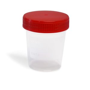 Urinprobenbecher mit Deckel